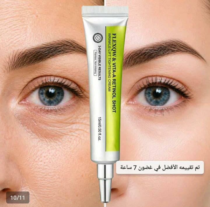 ريتنول